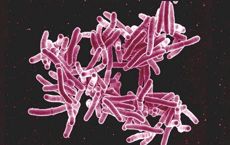 Egypt: TB Rates Halved Since 1990
