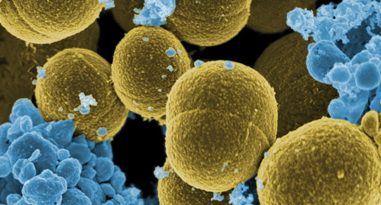 The Fight Against Superbugs: Properly Incentivising Antimicrobial R&D Is Key
